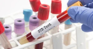 Importance of STD Testing