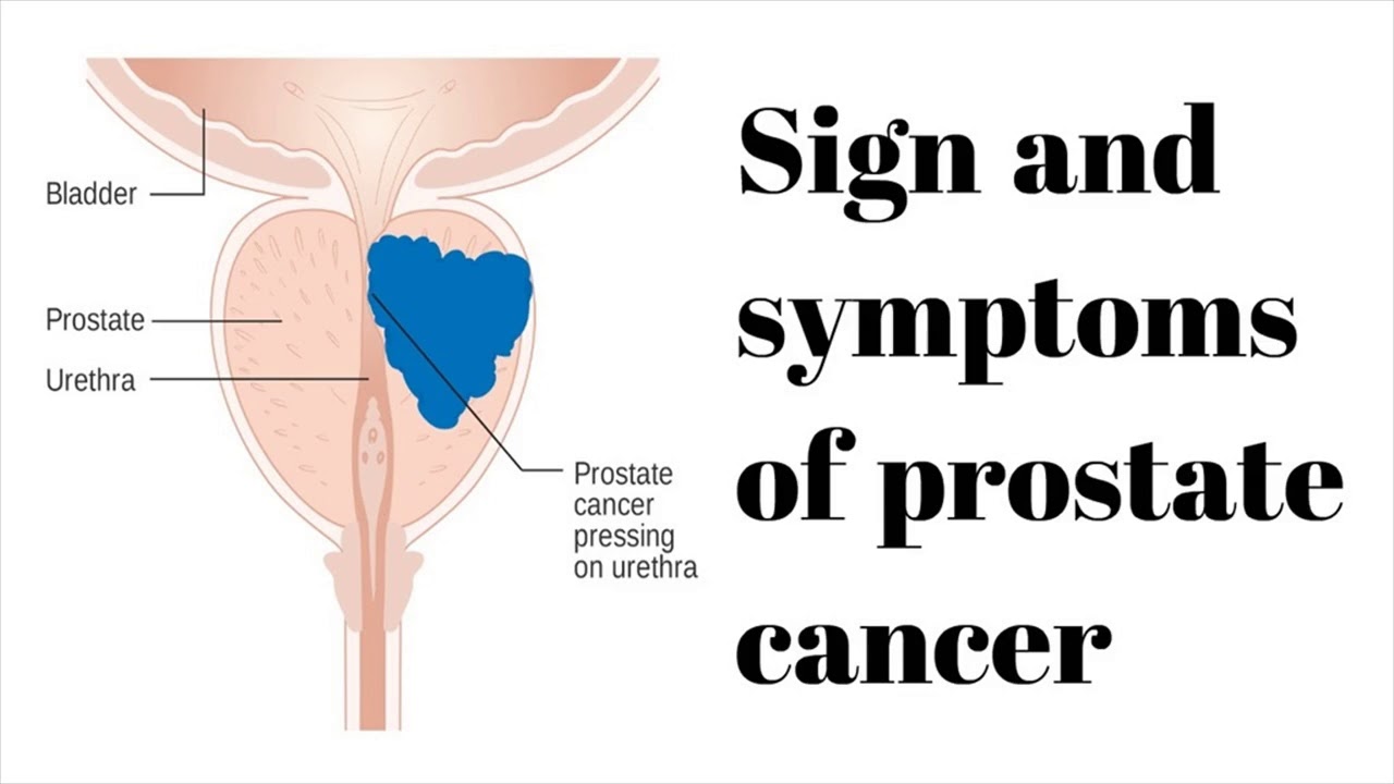 What Are the Signs of Prostate Issues in Floral Park Men? - FirstPointMD