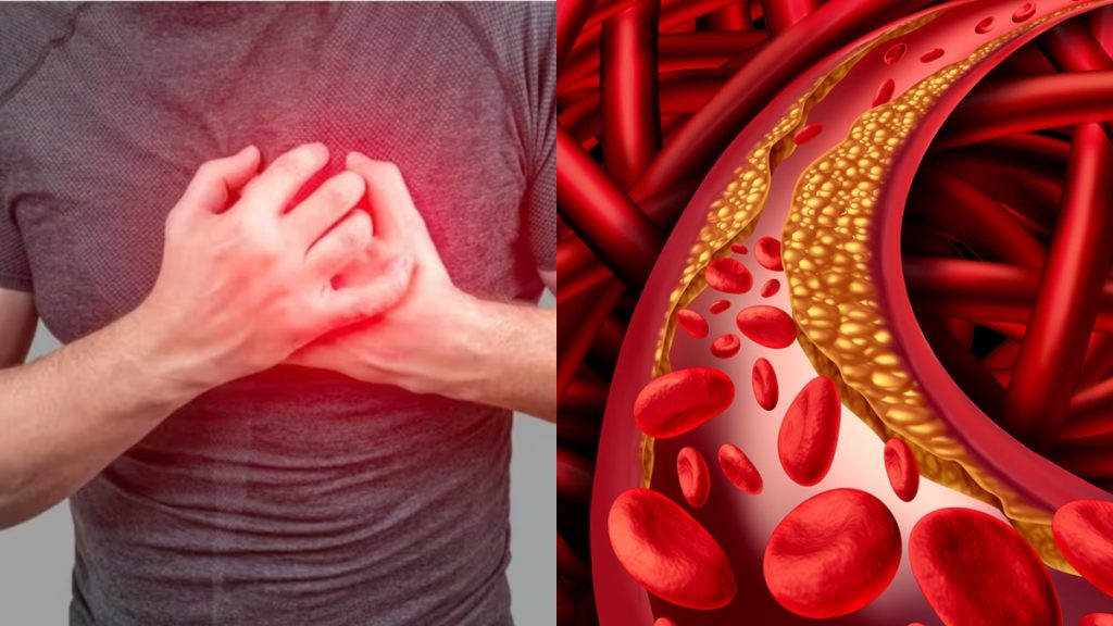 Cholesterol Hits Men Differently: Proven Ways to Protect Your Heart
