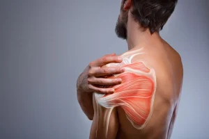 Rotator Cuff Injuries in Weekend Athletes