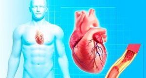 Rheumatic Heart Disease and Valve Involvement Require Careful Diagnosis, Management, and Prevention