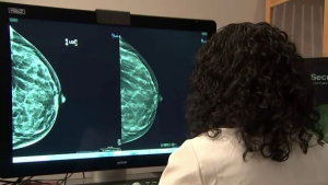 The Role of Women’s Cancer Screening in Reducing Cancer Mortality and Improving Survival Rate