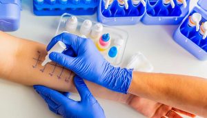 Allergy Testing Explained: How Doctors Identify the Exact Cause of Allergic Reactions