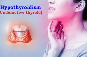 Can an Underactive Thyroid Cause Irregular Heartbeats or Skipped Beats