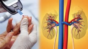 Can Diabetic Kidney Disease Be Reversed? Treatment Options and Lifestyle Changes Explained