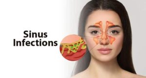 Sinus Infection vs Migraine: How to Identify the Source of Your Headache